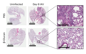 Nature Immunology:重新平衡免疫系統 Nature Immunology:重新平衡免疫系統