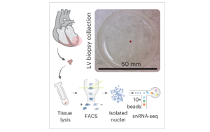 Nature Cardiovascular Research:心臟炎癥的關鍵差異 Nature Cardiovascular Research:心臟炎癥的關鍵差異