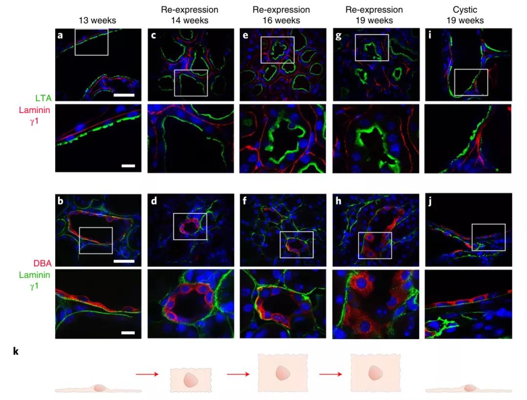 無需腎移植！Nature子刊：科學家通過逆轉小鼠多囊腎病揭示腎臟的可塑性