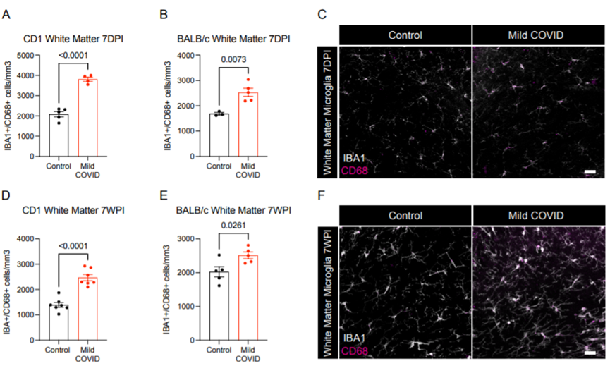 新冠竟能“傷腦”？耶魯科學家找到SARS-CoV-2損害神經系統新證據