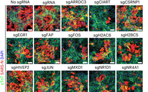 確定了導致SARS-CoV-2感染的人類基因——CIART 確定了導致SARS-CoV-2感染的人類基因——CIART