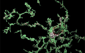 Nature子刊:血管周圍細胞誘發阿爾茨海默病相關的微膠質功能障礙 Nature子刊:血管周圍細胞誘發阿爾茨海默病相關的微膠質功能障礙
