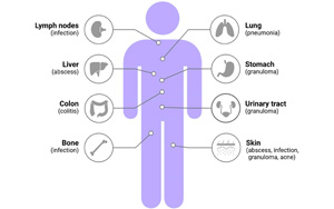 mNGS在診斷血流感染方面優(yōu)于常規(guī)微生物檢測