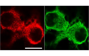 《PNAS》從過度反應(yīng)蛋白合成到認(rèn)知障礙,敲除1個基因即可 《PNAS》從過度反應(yīng)蛋白合成到認(rèn)知障礙,敲除1個基因即可