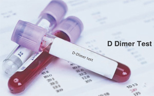 D-二聚體(D-Dimer)-磁微粒化學(xué)發(fā)光法(吖啶酯) /熒光免疫層析解決方案 D-二聚體(D-Dimer)-磁微粒化學(xué)發(fā)光法(吖啶酯) /熒光免疫層析解決方案