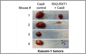 Leukemia:基于CRISPR的基因療法為白血病治療帶來希望 Leukemia:基于CRISPR的基因療法為白血病治療帶來希望