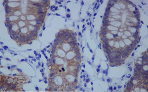 《PNAS》一種不為人知的蛋白質，它能保持人體細胞的健康
