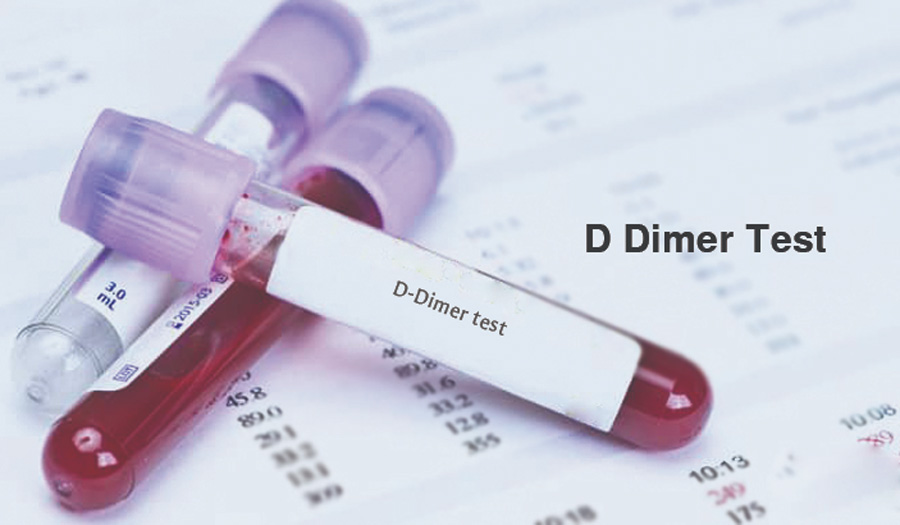 D-二聚體（D-Dimer）-磁微粒化學法學發光（AP/AE） /熒光免疫層析解決方案