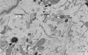 Nature Microbiology:一種以前未知的免疫反應途徑 Nature Microbiology:一種以前未知的免疫反應途徑